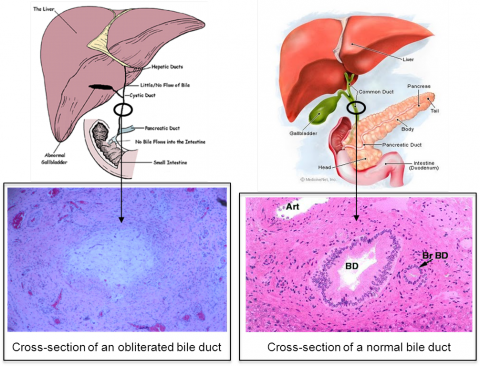 liver_img1